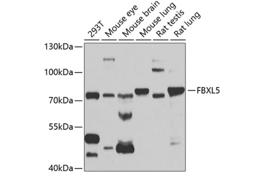 Western Blot - Anti-FBXL5 Antibody (A14857) - Antibodies.com