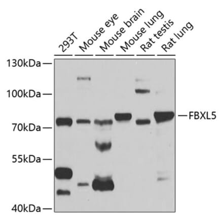 Western Blot - Anti-FBXL5 Antibody (A14857) - Antibodies.com