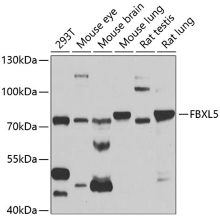 Western Blot - Anti-FBXL5 Antibody (A14857) - Antibodies.com