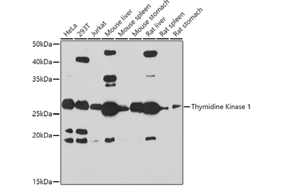 Western Blot - Anti-Thymidine Kinase 1/TK1 Antibody (A14858) - Antibodies.com
