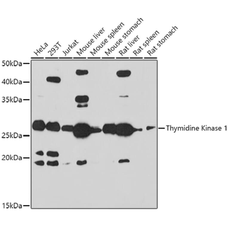 Western Blot - Anti-Thymidine Kinase 1/TK1 Antibody (A14858) - Antibodies.com