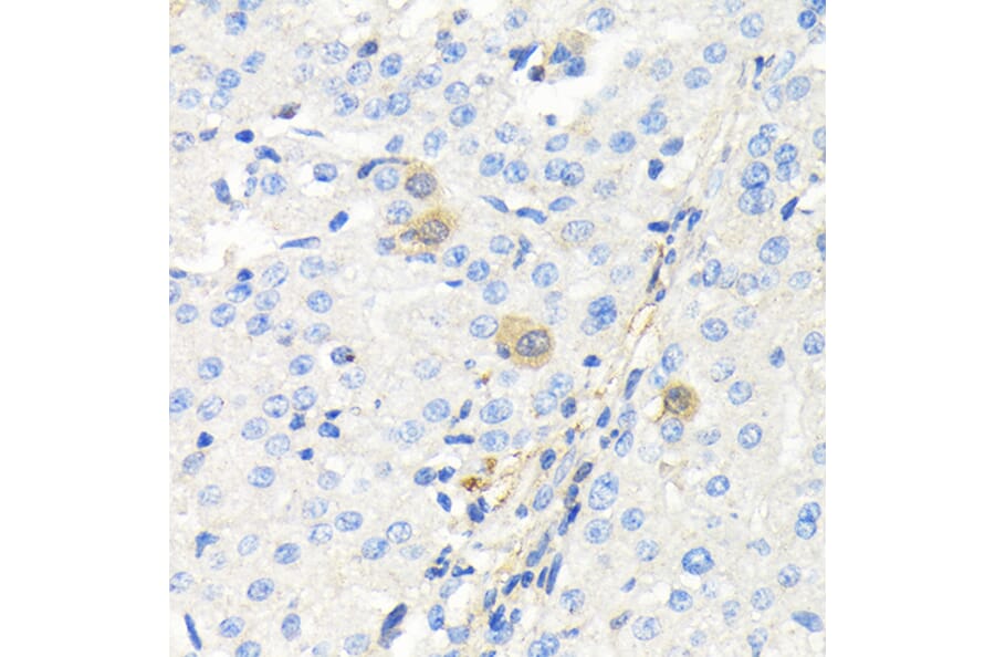 Immunohistochemistry - Anti-Thymidine Kinase 1/TK1 Antibody (A14858) - Antibodies.com