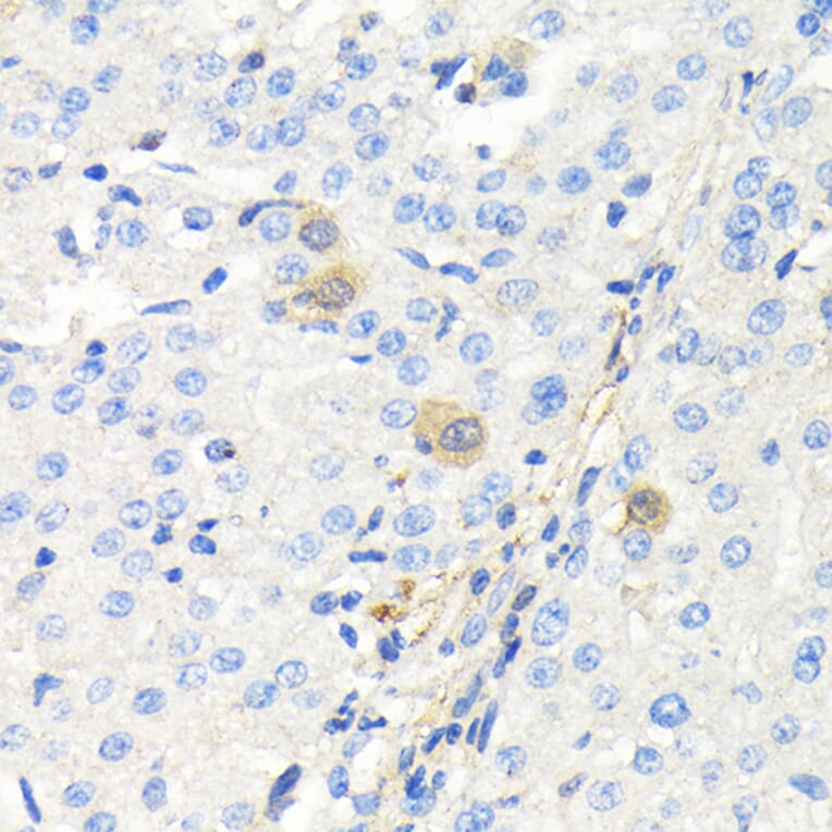 Immunohistochemistry - Anti-Thymidine Kinase 1/TK1 Antibody (A14858) - Antibodies.com