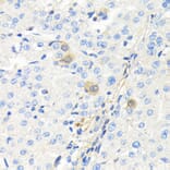 Immunohistochemistry - Anti-Thymidine Kinase 1/TK1 Antibody (A14858) - Antibodies.com