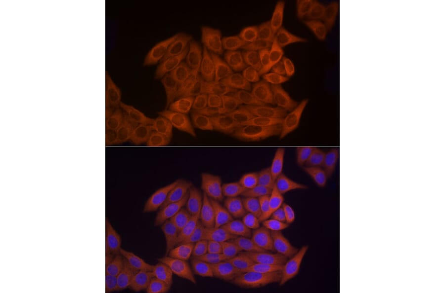 Immunofluorescence - Anti-Thymidine Kinase 1/TK1 Antibody (A14858) - Antibodies.com
