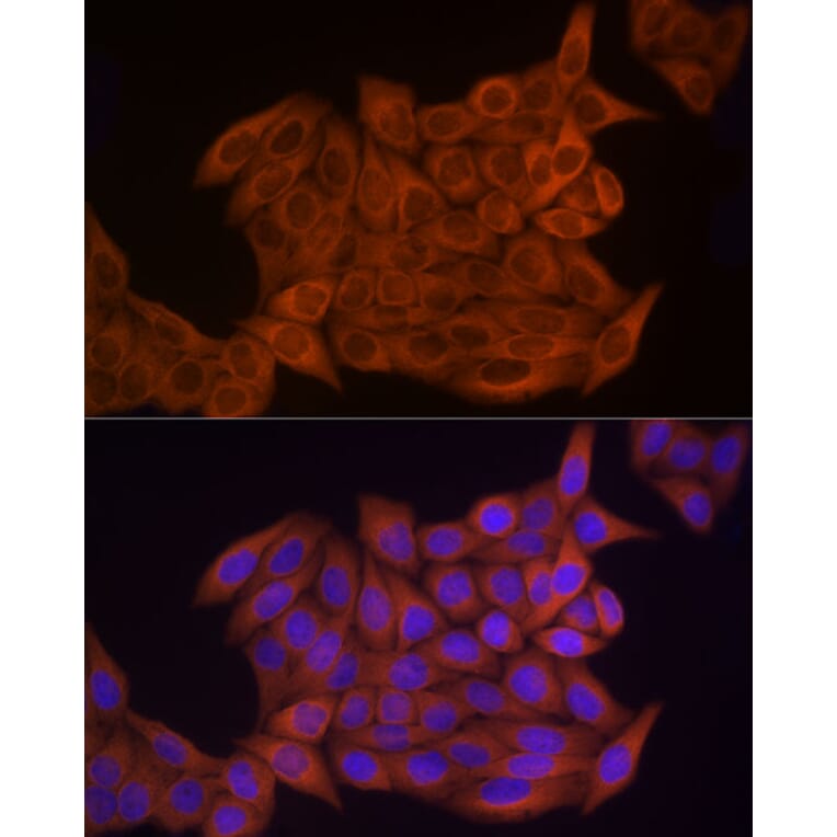 Immunofluorescence - Anti-Thymidine Kinase 1/TK1 Antibody (A14858) - Antibodies.com