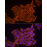 Immunofluorescence - Anti-Thymidine Kinase 1/TK1 Antibody (A14858) - Antibodies.com