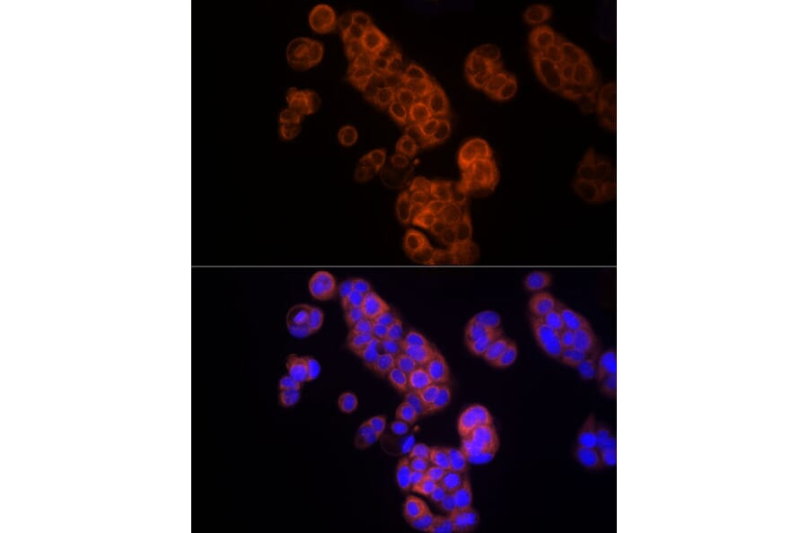Immunofluorescence - Anti-Thymidine Kinase 1/TK1 Antibody (A14858) - Antibodies.com