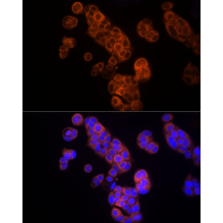 Immunofluorescence - Anti-Thymidine Kinase 1/TK1 Antibody (A14858) - Antibodies.com