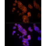 Immunofluorescence - Anti-Thymidine Kinase 1/TK1 Antibody (A14858) - Antibodies.com