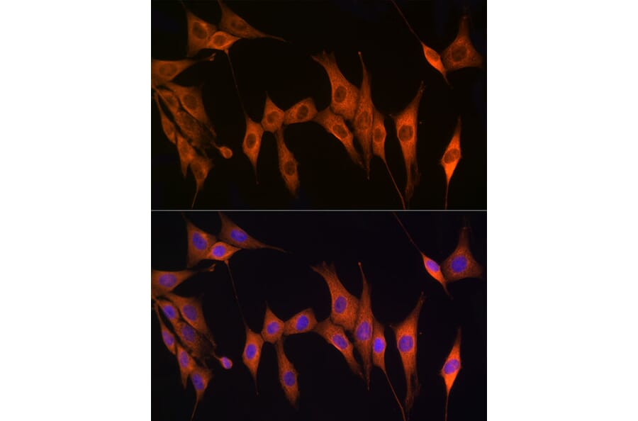 Immunofluorescence - Anti-Thymidine Kinase 1/TK1 Antibody (A14858) - Antibodies.com
