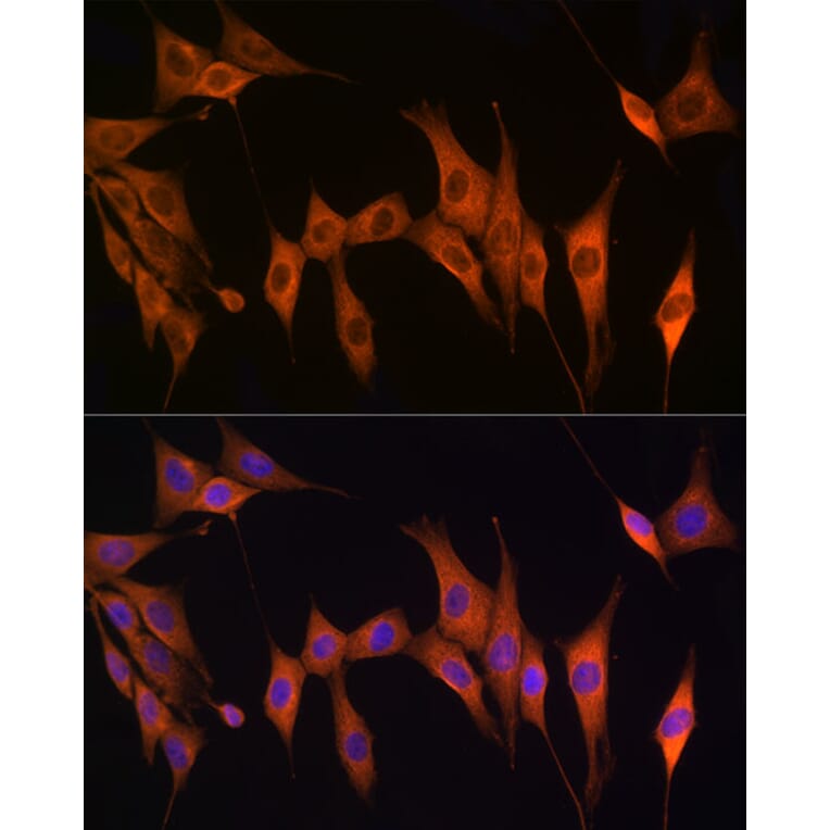 Immunofluorescence - Anti-Thymidine Kinase 1/TK1 Antibody (A14858) - Antibodies.com
