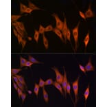 Immunofluorescence - Anti-Thymidine Kinase 1/TK1 Antibody (A14858) - Antibodies.com