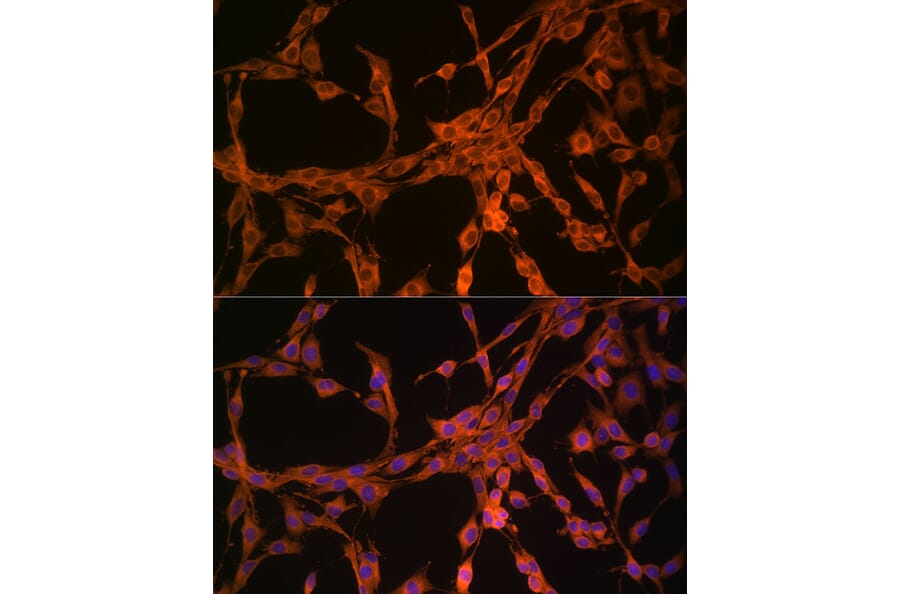 Immunofluorescence - Anti-Thymidine Kinase 1/TK1 Antibody (A14858) - Antibodies.com