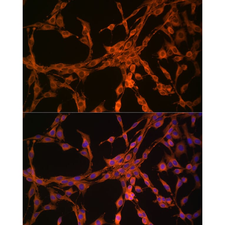 Immunofluorescence - Anti-Thymidine Kinase 1/TK1 Antibody (A14858) - Antibodies.com
