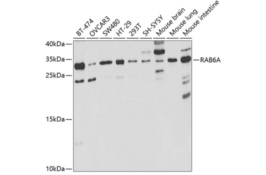 Western Blot - Anti-Rab 6A Antibody (A14859) - Antibodies.com
