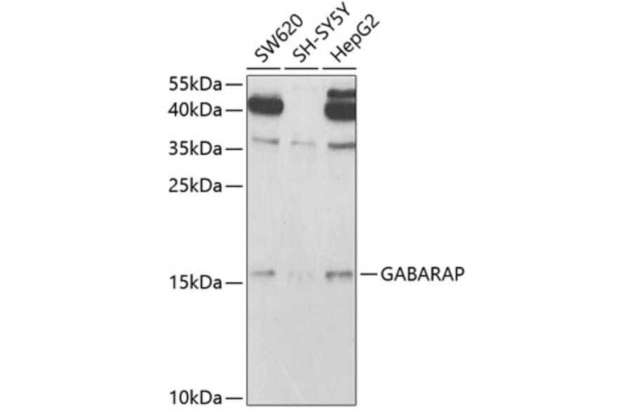 Western Blot - Anti-GABARAP Antibody (A14861) - Antibodies.com