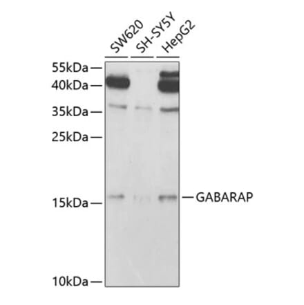 Western Blot - Anti-GABARAP Antibody (A14861) - Antibodies.com