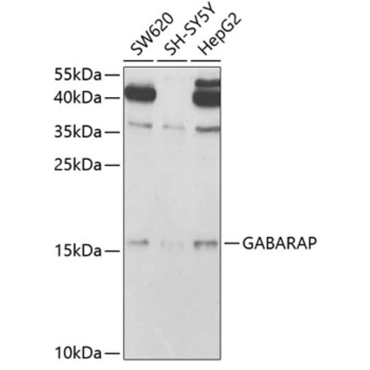 Western Blot - Anti-GABARAP Antibody (A14861) - Antibodies.com