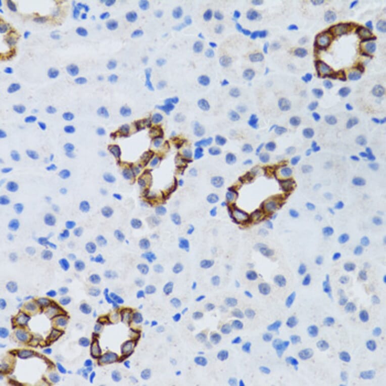 Immunohistochemistry - Anti-GABARAP Antibody (A14861) - Antibodies.com