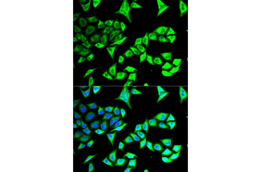 Immunofluorescence - Anti-GABARAP Antibody (A14861) - Antibodies.com