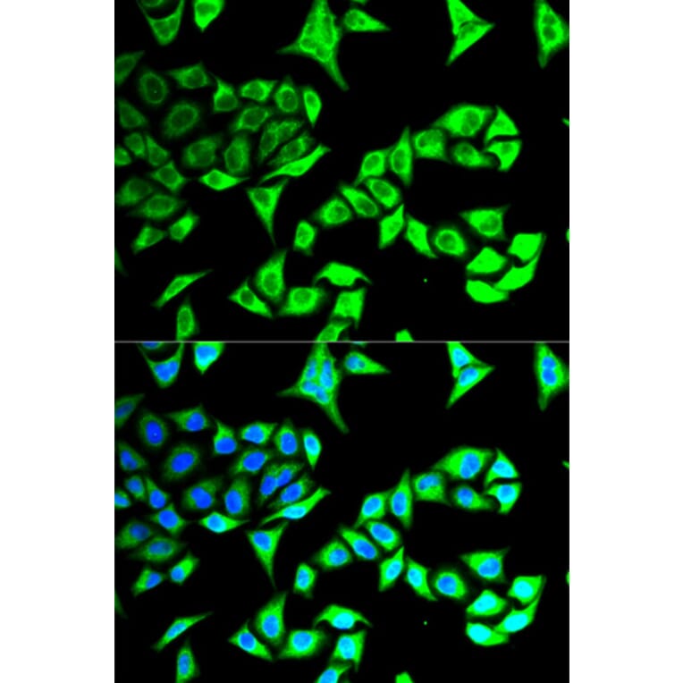 Immunofluorescence - Anti-GABARAP Antibody (A14861) - Antibodies.com