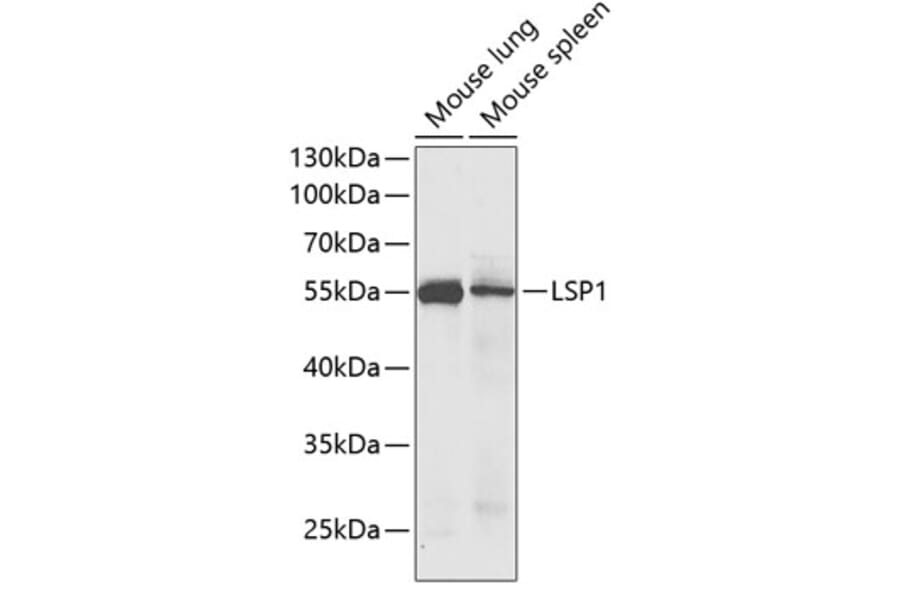 Western Blot - Anti-LSP1 Antibody (A14862) - Antibodies.com