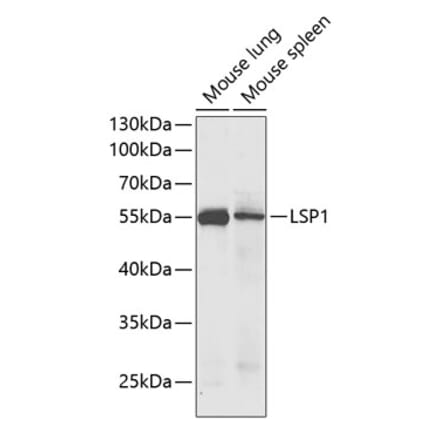 Western Blot - Anti-LSP1 Antibody (A14862) - Antibodies.com