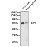 Western Blot - Anti-LSP1 Antibody (A14862) - Antibodies.com