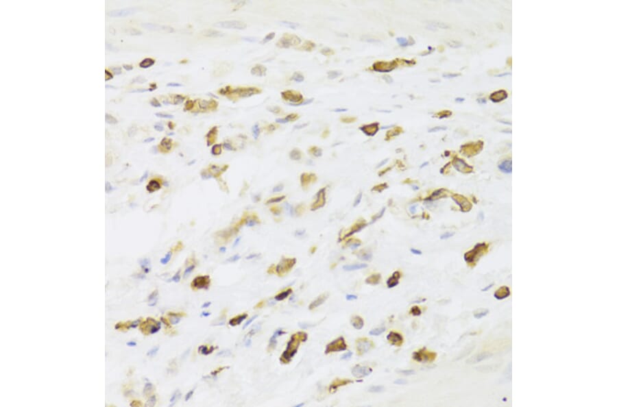Immunohistochemistry - Anti-LSP1 Antibody (A14862) - Antibodies.com