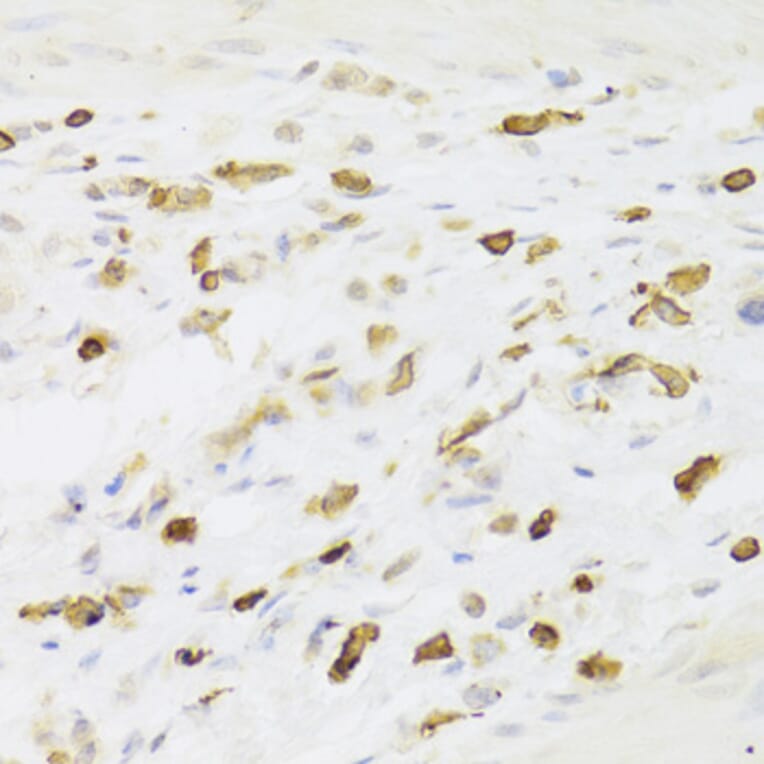 Immunohistochemistry - Anti-LSP1 Antibody (A14862) - Antibodies.com