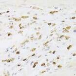 Immunohistochemistry - Anti-LSP1 Antibody (A14862) - Antibodies.com