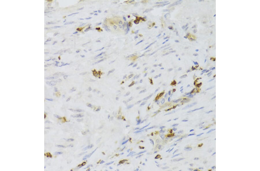 Immunohistochemistry - Anti-LSP1 Antibody (A14862) - Antibodies.com