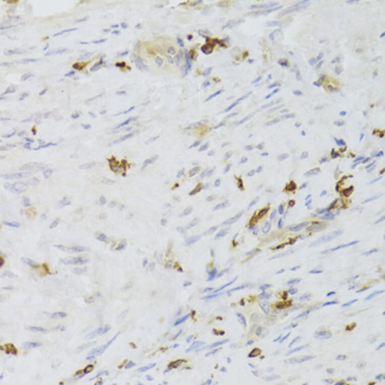Immunohistochemistry - Anti-LSP1 Antibody (A14862) - Antibodies.com