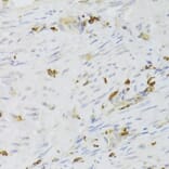 Immunohistochemistry - Anti-LSP1 Antibody (A14862) - Antibodies.com