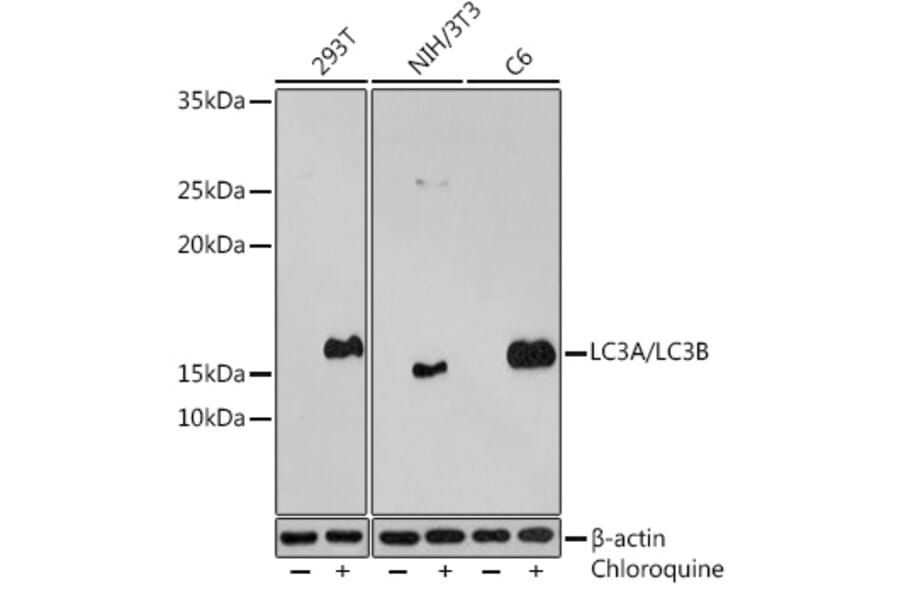 Western Blot - Anti-MAP1LC3A + LC3B Antibody (A14863) - Antibodies.com