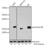 Western Blot - Anti-MAP1LC3A + LC3B Antibody (A14863) - Antibodies.com