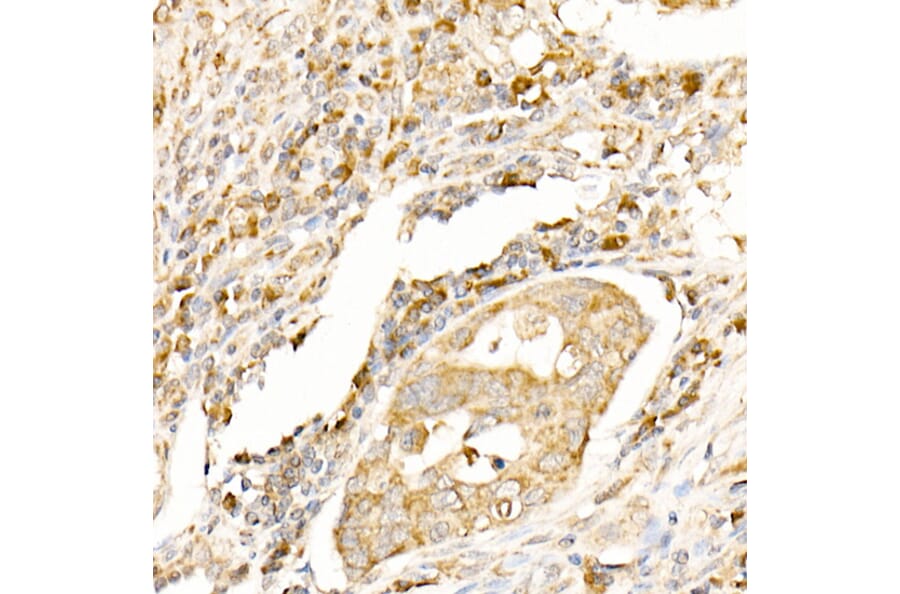 Immunohistochemistry - Anti-MAP1LC3A + LC3B Antibody (A14863) - Antibodies.com