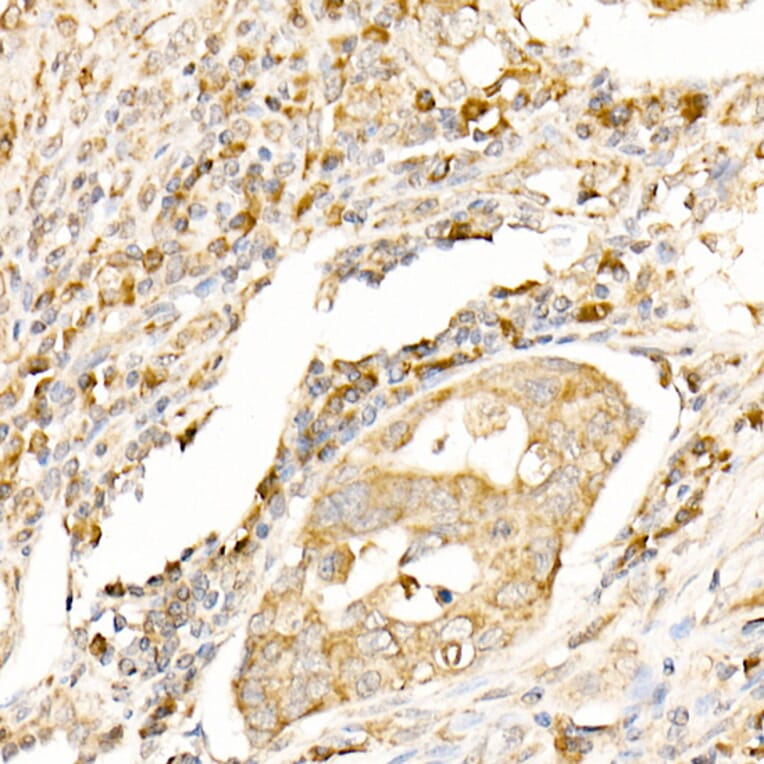 Immunohistochemistry - Anti-MAP1LC3A + LC3B Antibody (A14863) - Antibodies.com