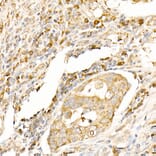 Immunohistochemistry - Anti-MAP1LC3A + LC3B Antibody (A14863) - Antibodies.com