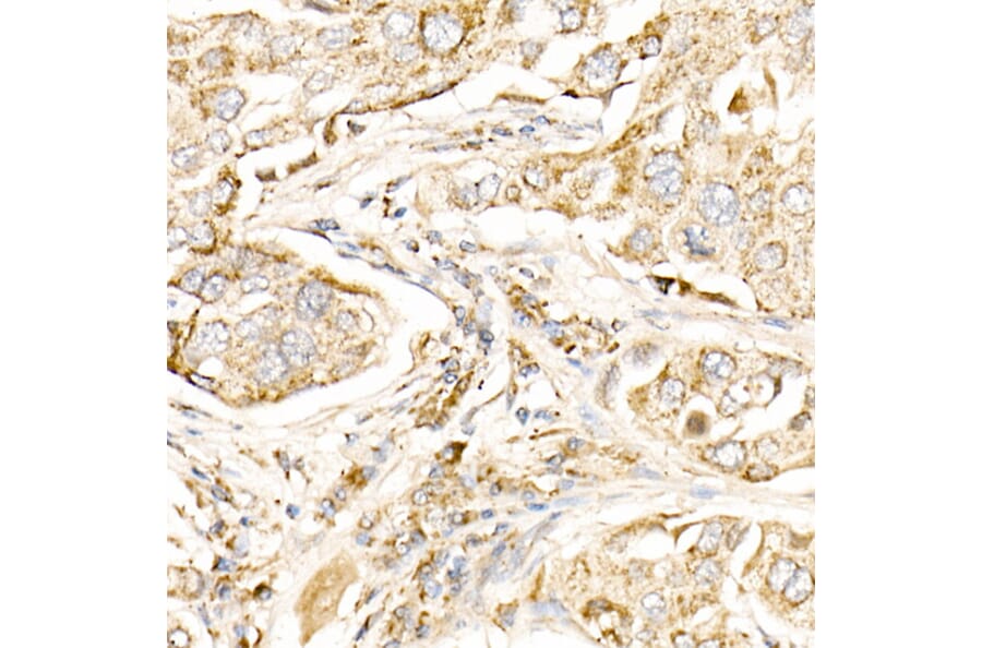 Immunohistochemistry - Anti-MAP1LC3A + LC3B Antibody (A14863) - Antibodies.com