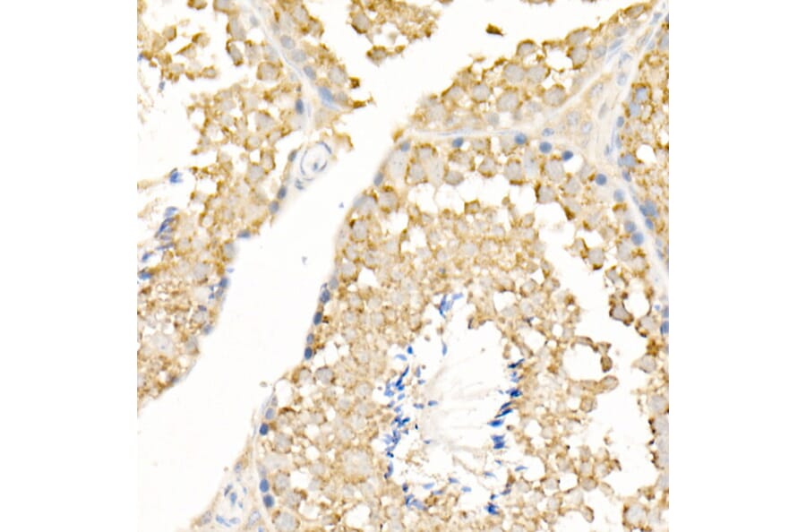 Immunohistochemistry - Anti-MAP1LC3A + LC3B Antibody (A14863) - Antibodies.com