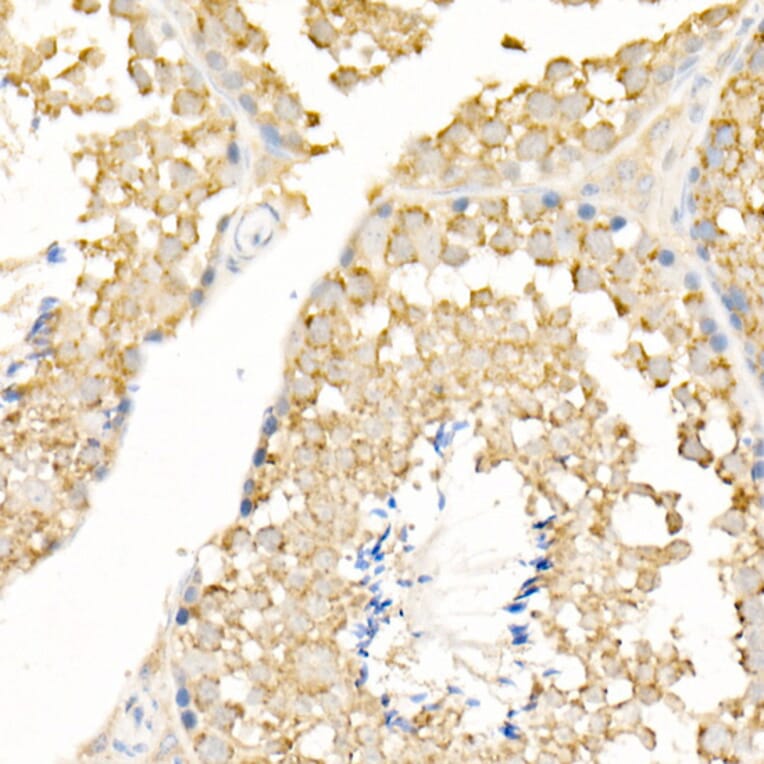 Immunohistochemistry - Anti-MAP1LC3A + LC3B Antibody (A14863) - Antibodies.com