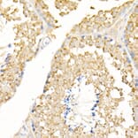 Immunohistochemistry - Anti-MAP1LC3A + LC3B Antibody (A14863) - Antibodies.com