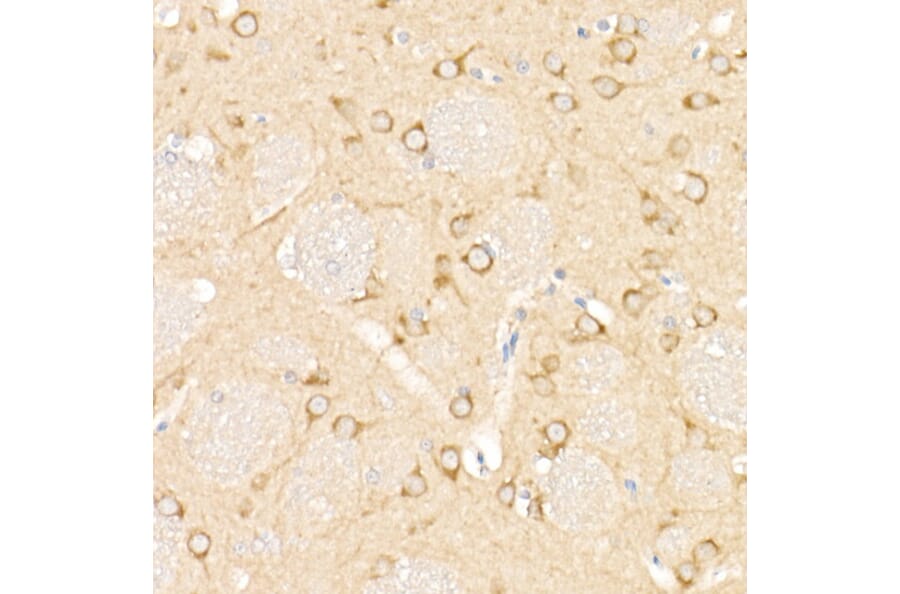 Immunohistochemistry - Anti-MAP1LC3A + LC3B Antibody (A14863) - Antibodies.com