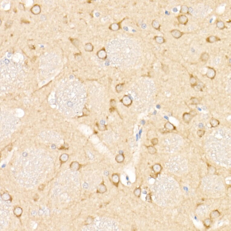 Immunohistochemistry - Anti-MAP1LC3A + LC3B Antibody (A14863) - Antibodies.com