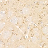 Immunohistochemistry - Anti-MAP1LC3A + LC3B Antibody (A14863) - Antibodies.com