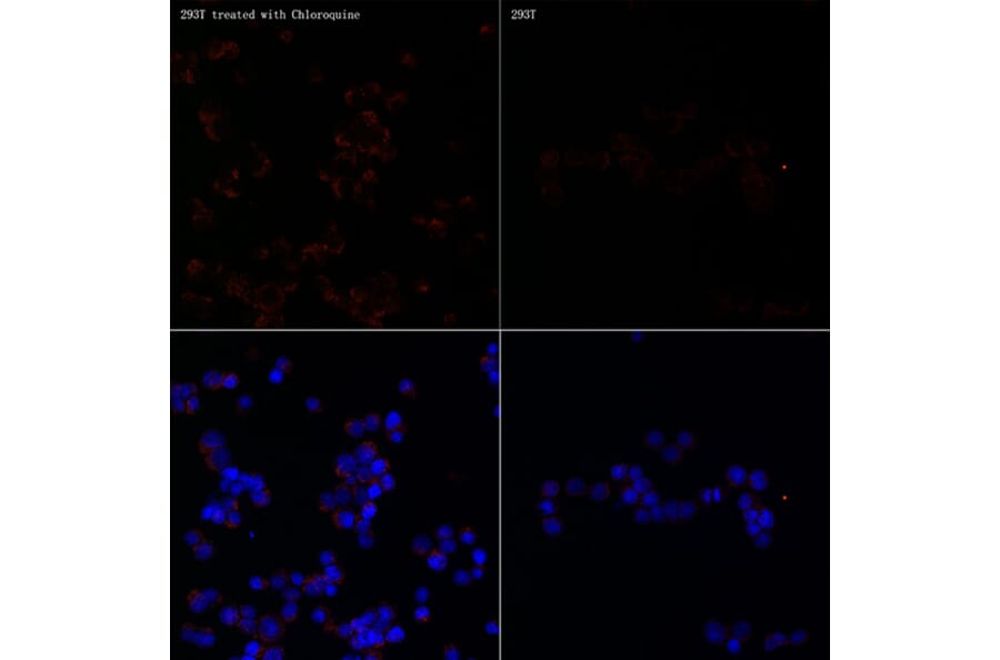 Immunofluorescence - Anti-MAP1LC3A + LC3B Antibody (A14863) - Antibodies.com