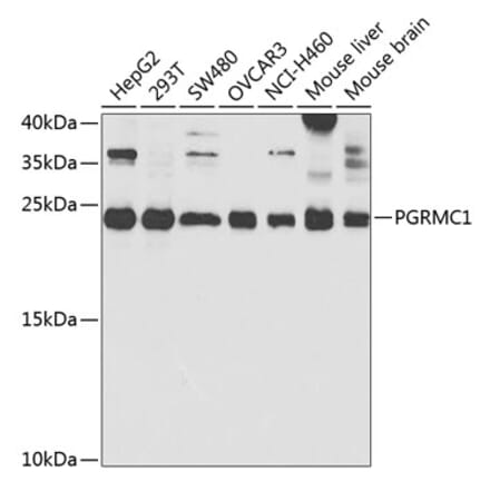 Western Blot - Anti-PGRMC1 Antibody (A14864) - Antibodies.com