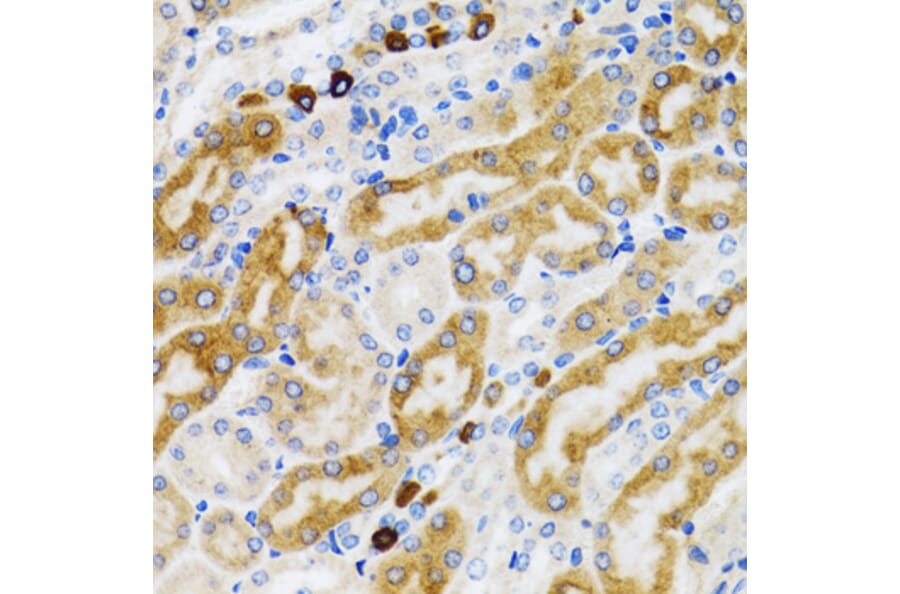 Immunohistochemistry - Anti-PGRMC1 Antibody (A14864) - Antibodies.com